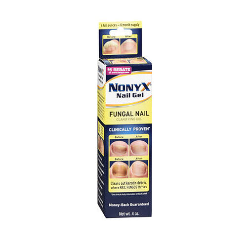 Xenna, Xenna Nonyx Nail Gel, Count of 1